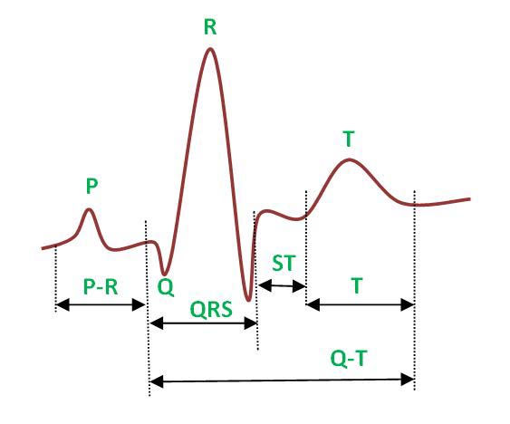Fig. 2 : Fall detection algorithm d) Algorithm: 2 1. Signal accusation a. Receive ECG signal 2. Pre-processing a. Filter signal for external noises baseline wander and high frequencies are removed by using a second order Butterworth filter with passband 0.5-10 Hz. s[n] = Butterworth(PTG[n],0.5 ?10Hz) b. Use differentiator the derivative method allows more accurate recognition of the inflection points and easier interpretation of the original wave. c. squaring the signal to amplify The signal squaring is taken for positive results and emphasizing of large differences 3. Feature extraction a. peak points are identified by comparing two moving windows 4. Result compared with threshold value, a. apply locally adaptive thresh holding using Pan and Tompkin's method b. evaluate possible QRS complex range c. discard out of range data 5. Register beat a. QRS complex candidate selection IV.