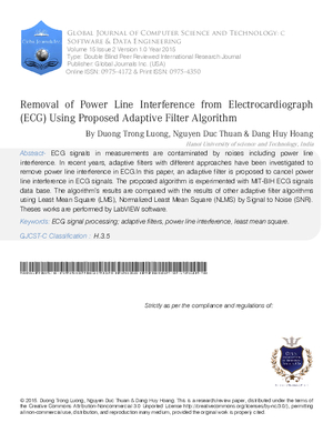 Removal of Power Line Interference from Electrocardiograph (ECG) using Proposed Adaptive Filter Algorithm